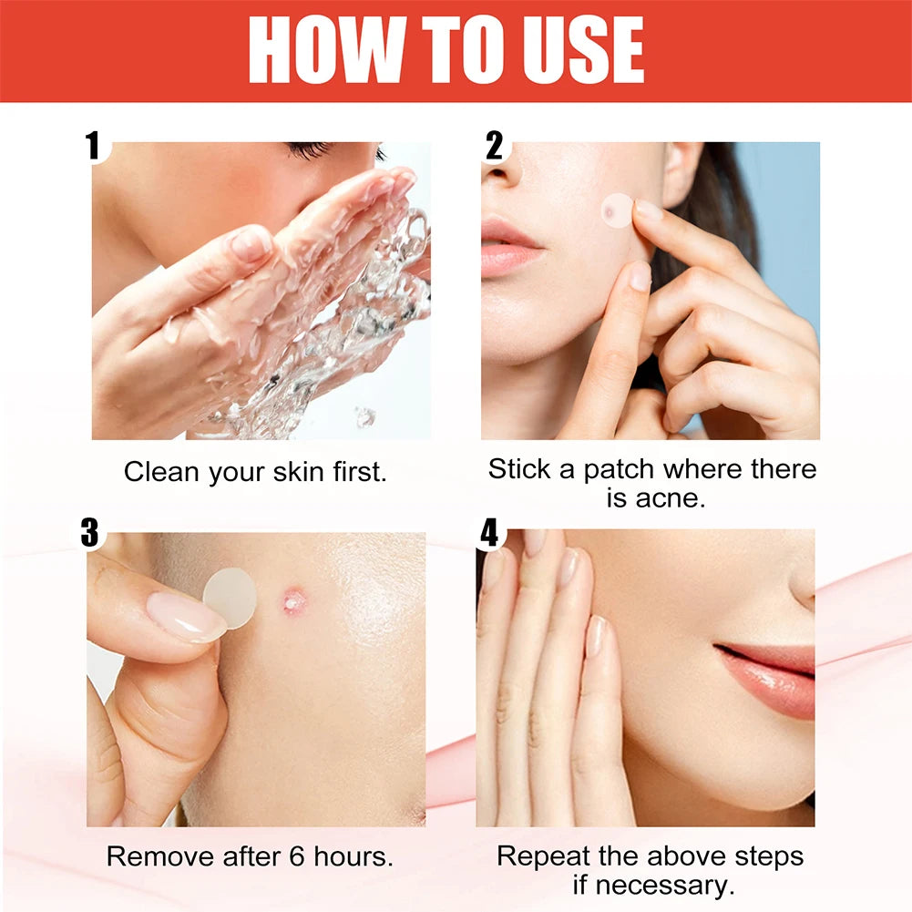 Acne Pimple Patch 2 Sizes 144pcs Invisible Professional Healing Absorbing Spot For Skin Care