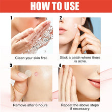 Load image into Gallery viewer, 144pcs/set Face Skin Care Acne Pimple Patch 2 Sizes Invisible Professional Healing Absorbing Spot Sticker Covering for Men Women
