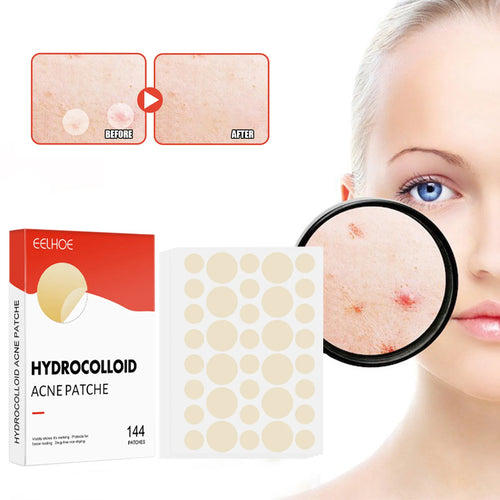 Acne Pimple Patch 2 Sizes 144pcs Invisible Professional Healing Absorbing Spot For Skin Care
