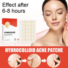 Load image into Gallery viewer, 144pcs/set Face Skin Care Acne Pimple Patch 2 Sizes Invisible Professional Healing Absorbing Spot Sticker Covering for Men Women