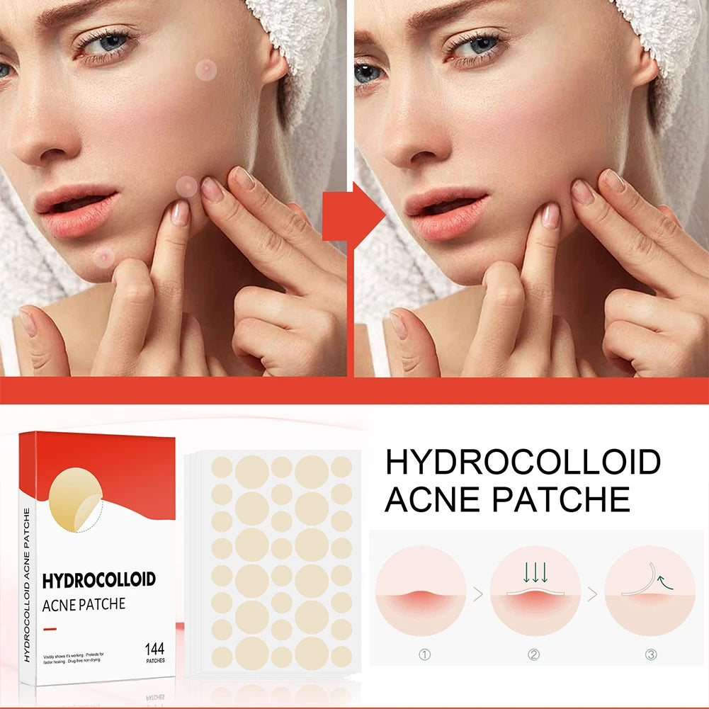 Acne Pimple Patch 2 Sizes 144pcs Invisible Professional Healing Absorbing Spot For Skin Care