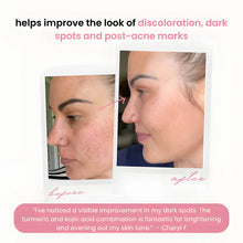 Load image into Gallery viewer, AdornPro Turmeric &amp; Kojic Acid Glow Pads | 40 Pack