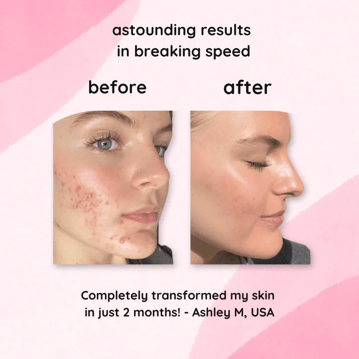 AdornPro Turmeric & Kojic Acid Glow Pads | 40 Pack